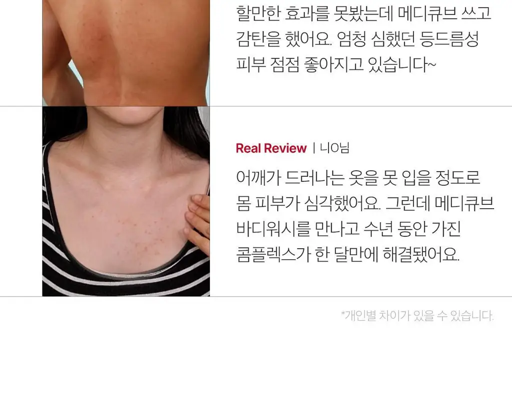 [등드름 바디워시] 메디큐브 레드 아크네 바디워시 400g 상세페이지 9